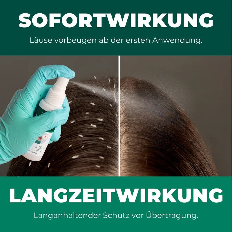 Kopfläusespray | Läuseabwehrspray Spray gegen Läuse / Kopfläuse
